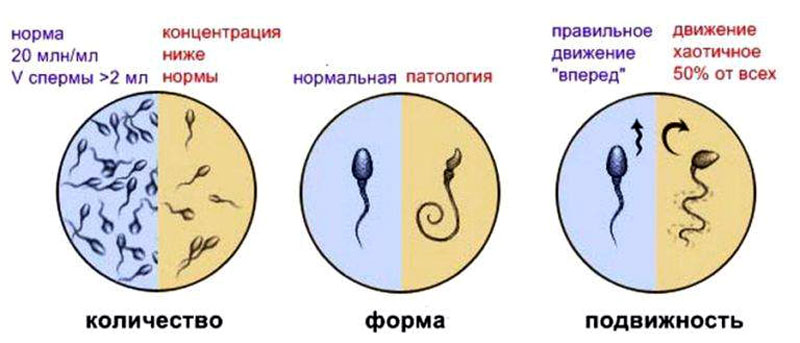 спермограмма,подвижность,количество,форма,предстательная железа
